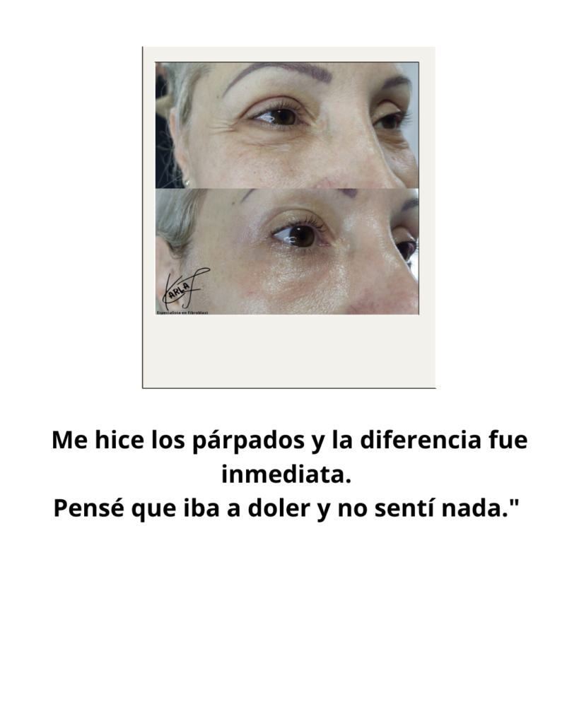 Plan BÁSICO (32)